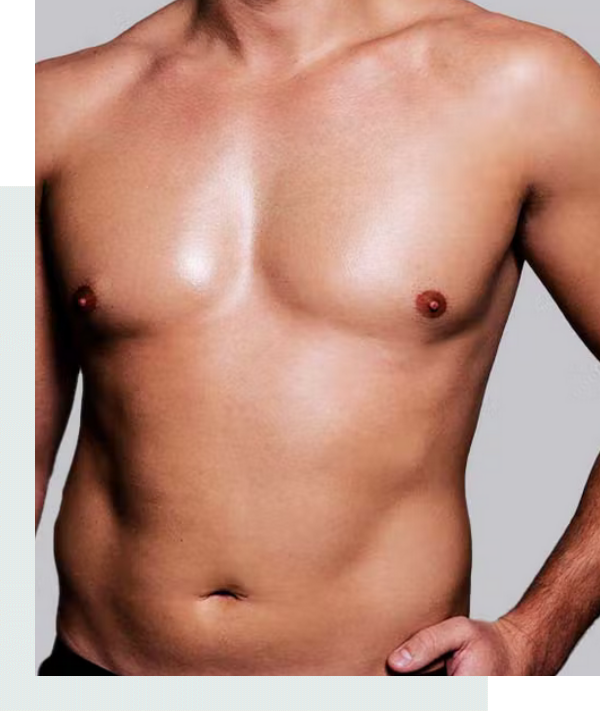 chirurgie-gynecomastie-tunisie