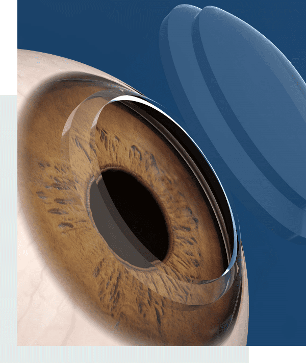 keratoplastie-yeux-tunisie-tarifs