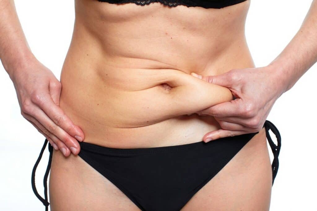 gonflement-apres-abdominoplastie