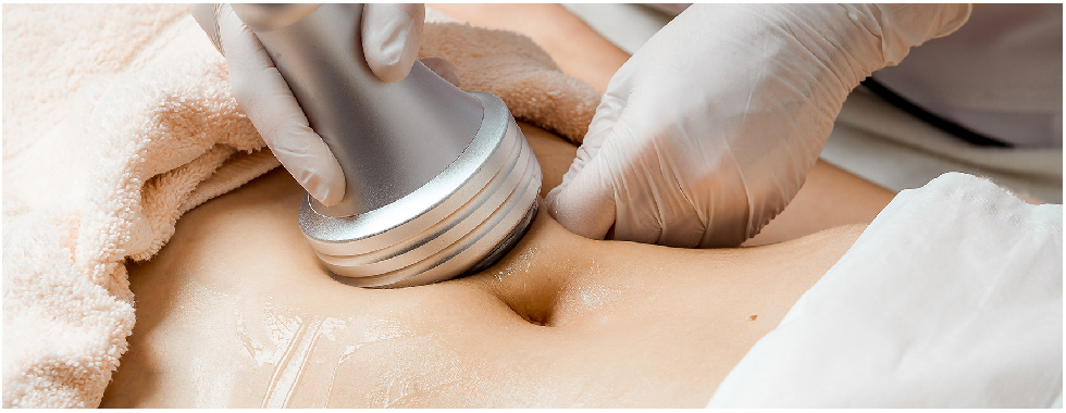 lipocavitation-avis-medecin