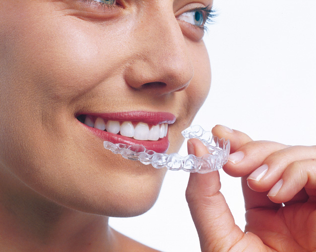 orthodontie-gouttiere-invisalign