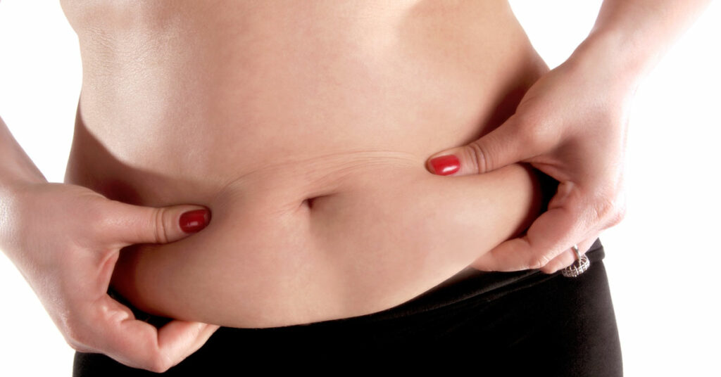 prendre-poids-apres-abdominoplastie